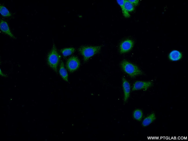 PIK3C2B Antibody in Immunocytochemistry (ICC/IF)