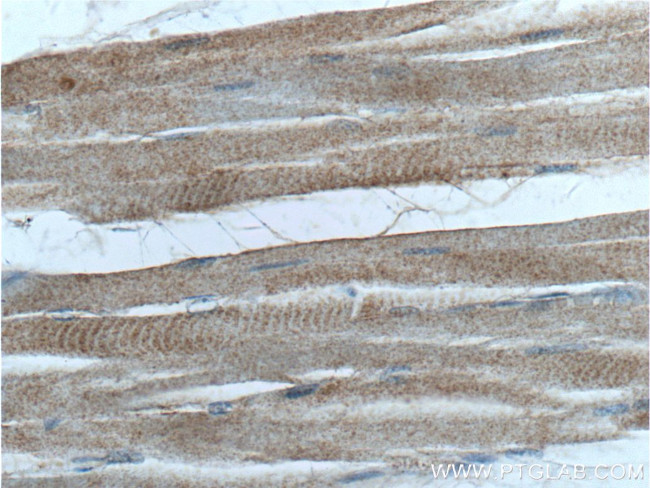 PIK3C2B Antibody in Immunohistochemistry (Paraffin) (IHC (P))