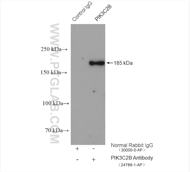 PIK3C2B Antibody in Immunoprecipitation (IP)