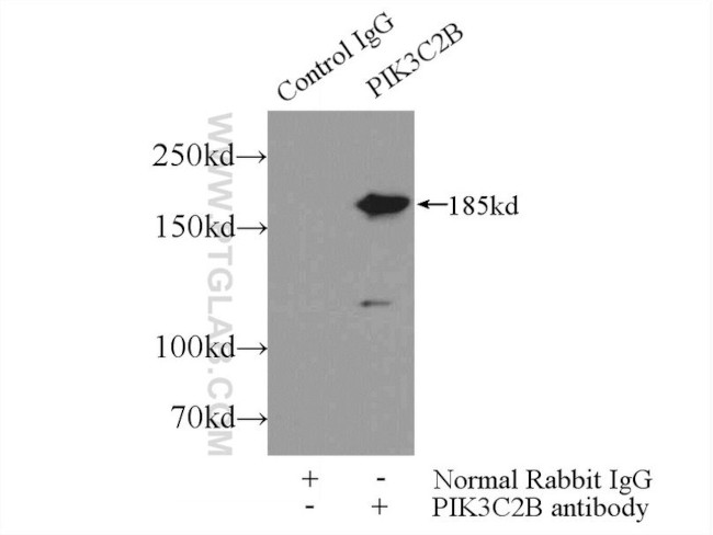 PIK3C2B Antibody in Immunoprecipitation (IP)