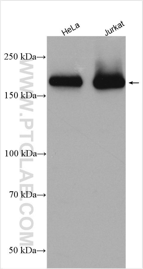 PIK3C2B Antibody in Western Blot (WB)