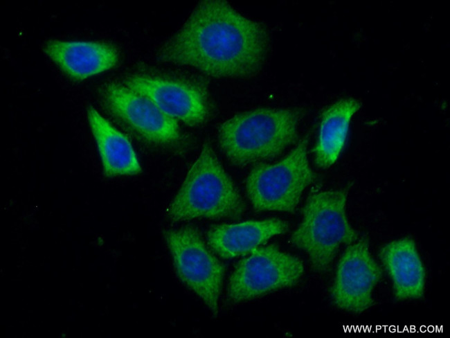 GIGYF2 Antibody in Immunocytochemistry (ICC/IF)