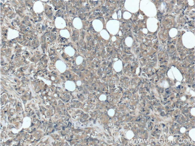 GIGYF2 Antibody in Immunohistochemistry (Paraffin) (IHC (P))