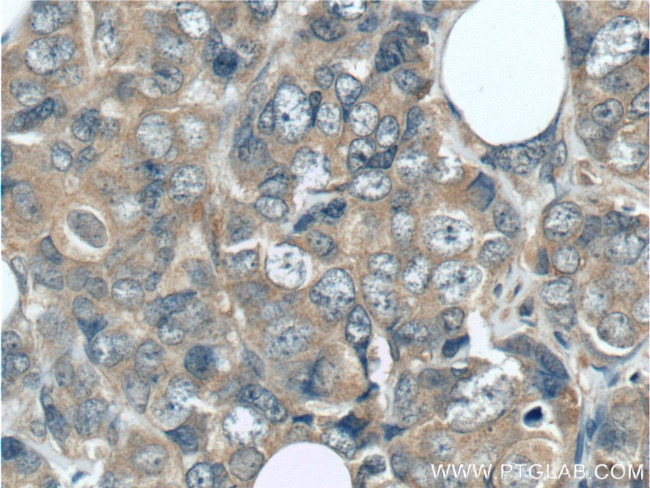 GIGYF2 Antibody in Immunohistochemistry (Paraffin) (IHC (P))