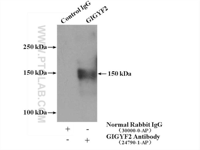 GIGYF2 Antibody in Immunoprecipitation (IP)