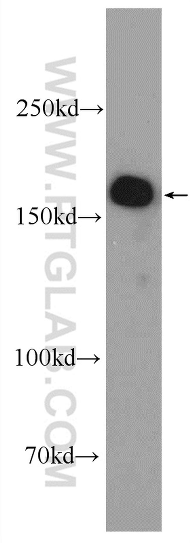 GIGYF2 Antibody in Western Blot (WB)