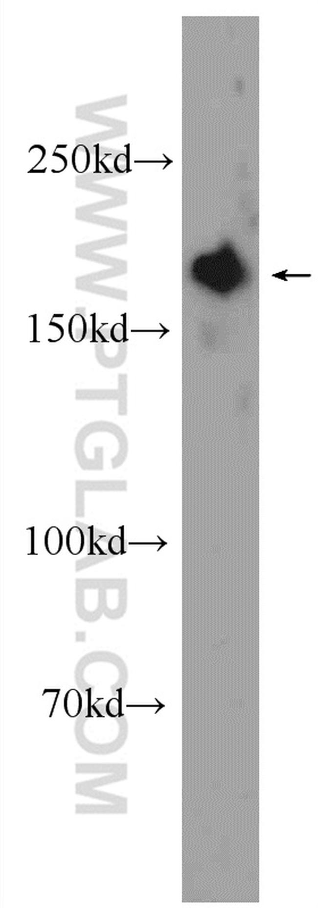 GIGYF2 Antibody in Western Blot (WB)