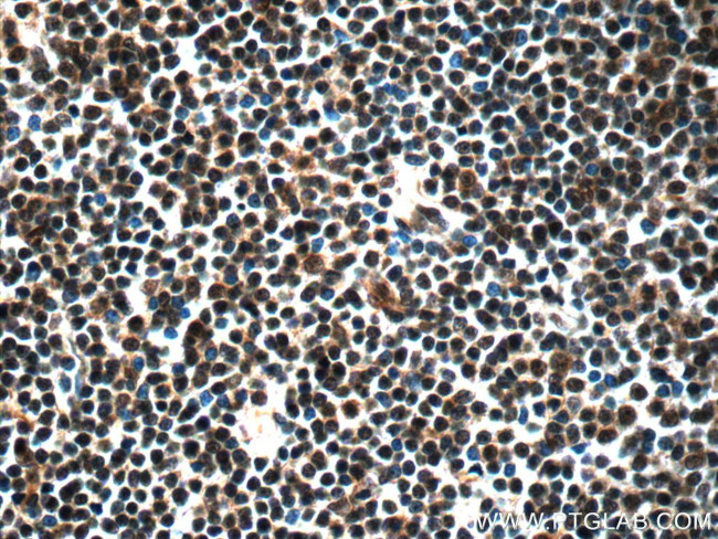 NALP1 Antibody in Immunohistochemistry (Paraffin) (IHC (P))