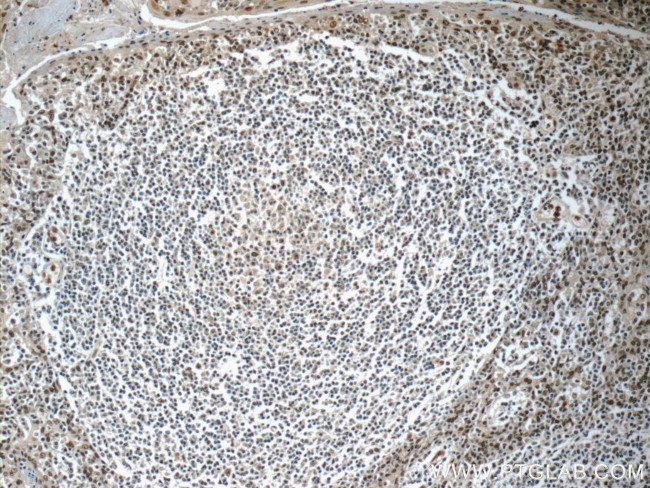 NALP1 Antibody in Immunohistochemistry (Paraffin) (IHC (P))