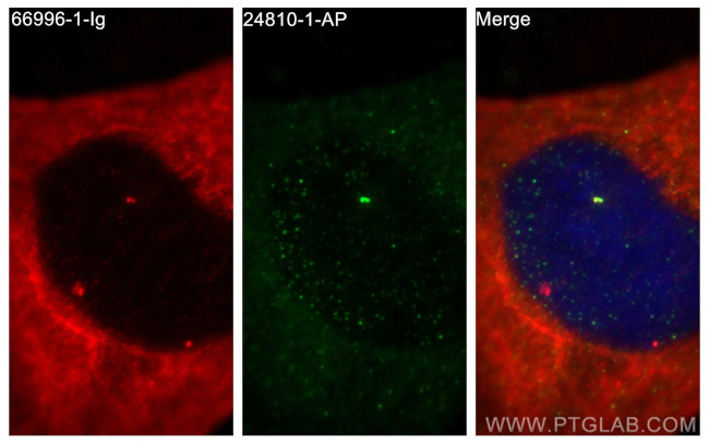 CEP128 Antibody in Immunocytochemistry (ICC/IF)