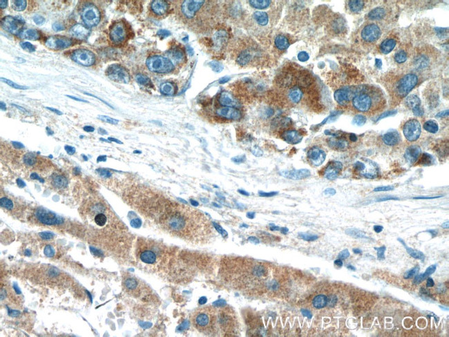 DMGDH Antibody in Immunohistochemistry (Paraffin) (IHC (P))