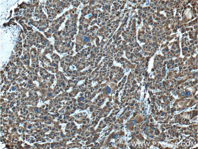 GLDC Antibody in Immunohistochemistry (Paraffin) (IHC (P))