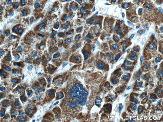 GLDC Antibody in Immunohistochemistry (Paraffin) (IHC (P))