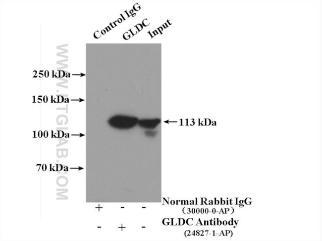 GLDC Antibody in Immunoprecipitation (IP)