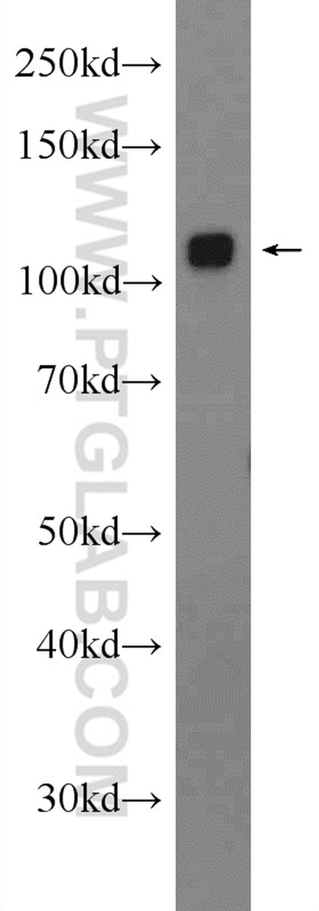 GLDC Antibody in Western Blot (WB)