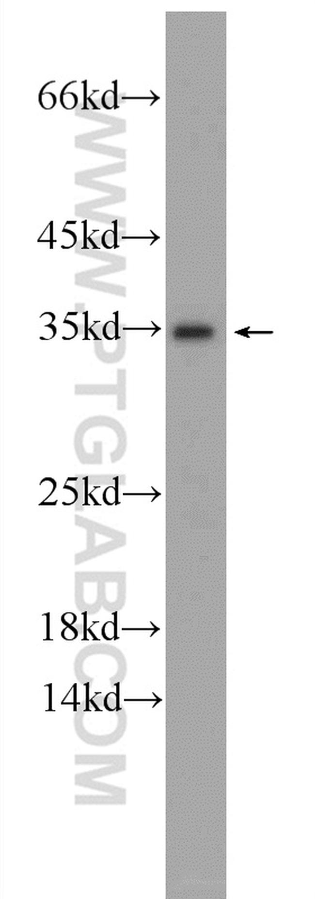 IDNK Antibody in Western Blot (WB)