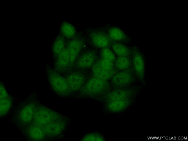 SETD7 Antibody in Immunocytochemistry (ICC/IF)