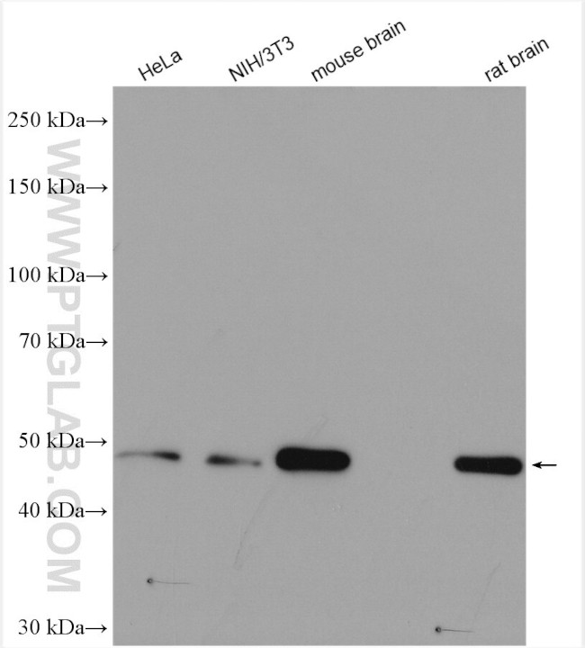 SETD7 Antibody in Western Blot (WB)