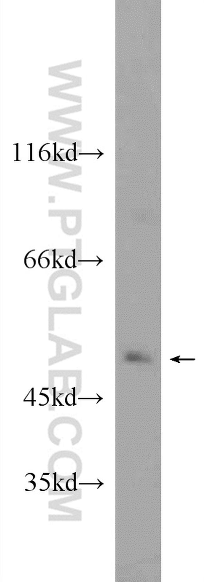 SETD7 Antibody in Western Blot (WB)