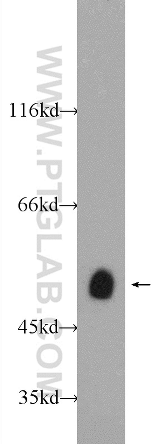 SETD7 Antibody in Western Blot (WB)