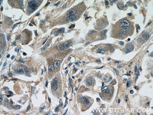 VISTA Antibody in Immunohistochemistry (Paraffin) (IHC (P))