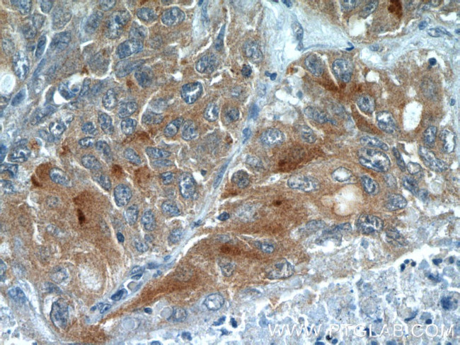 VISTA Antibody in Immunohistochemistry (Paraffin) (IHC (P))