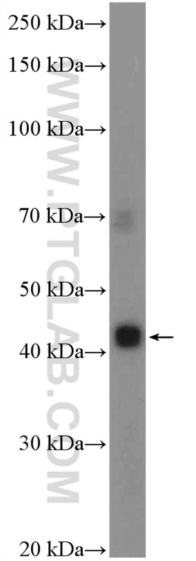 VISTA Antibody in Western Blot (WB)