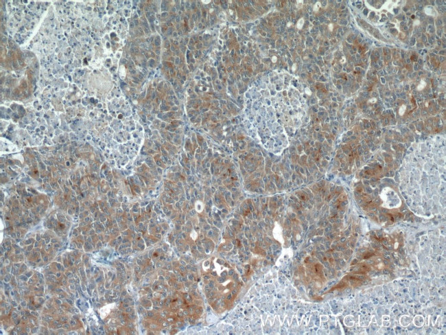 VISTA Antibody in Immunohistochemistry (Paraffin) (IHC (P))