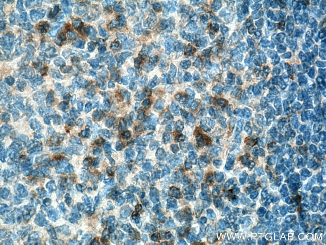 VISTA Antibody in Immunohistochemistry (Paraffin) (IHC (P))