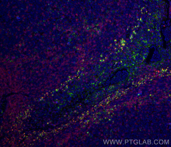 VISTA Antibody in Immunohistochemistry (PFA fixed) (IHC (PFA))