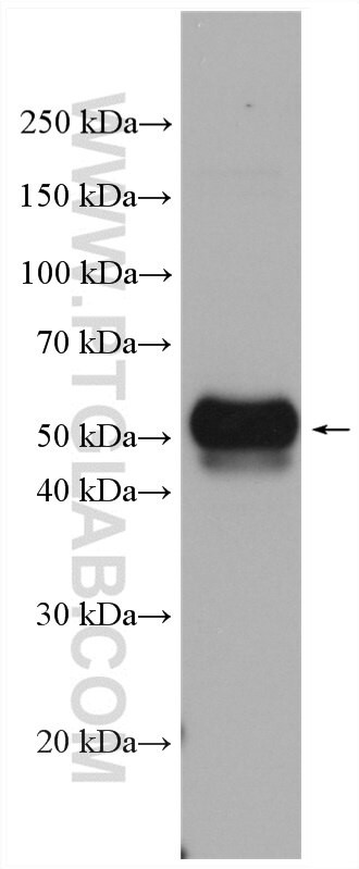 VISTA Antibody in Western Blot (WB)