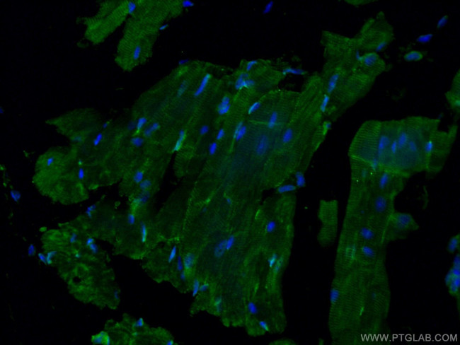 GAL3ST3 Antibody in Immunohistochemistry (PFA fixed) (IHC (PFA))