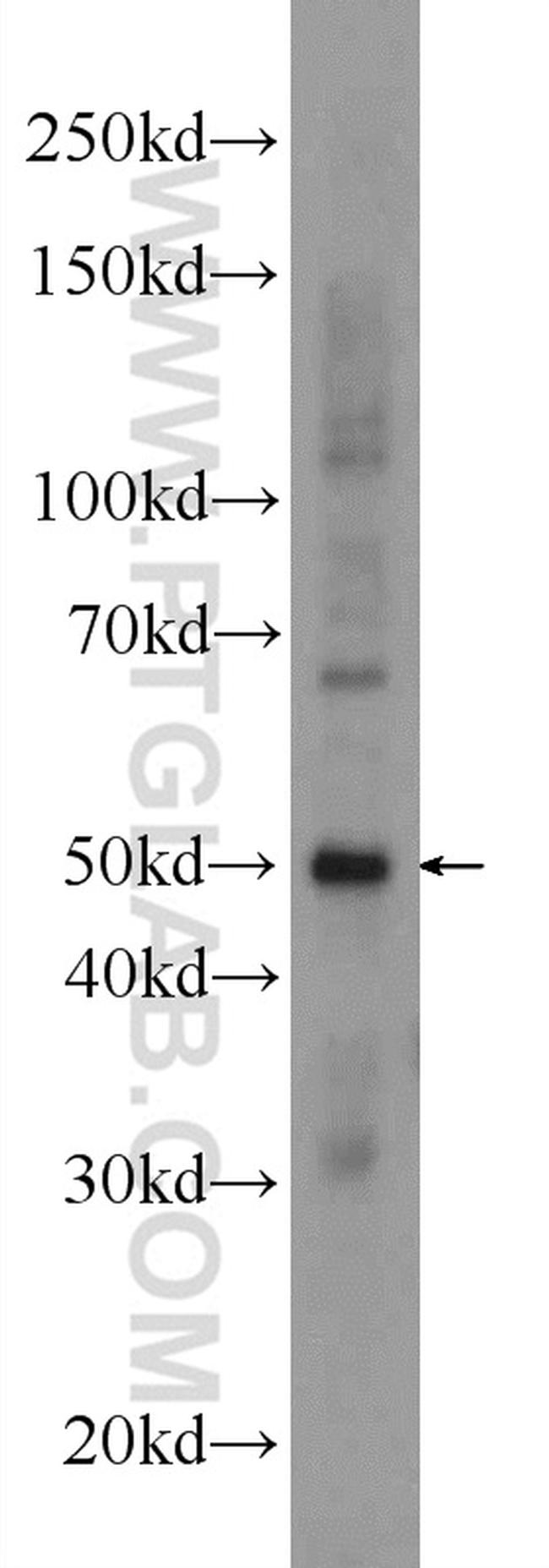 GAL3ST3 Antibody in Western Blot (WB)