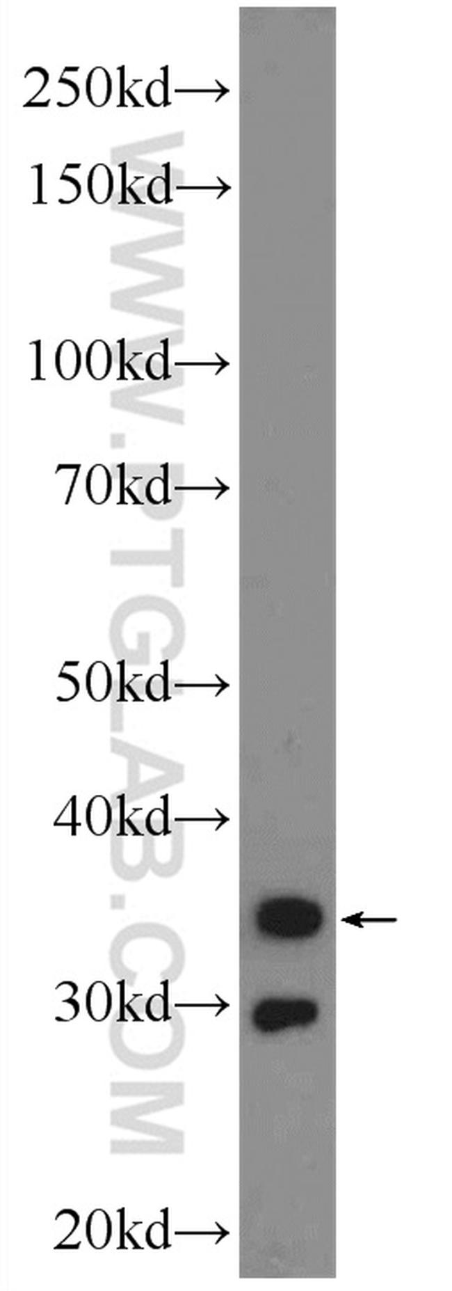 Calponin 1 Antibody in Western Blot (WB)