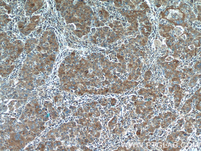 NRBF2 Antibody in Immunohistochemistry (Paraffin) (IHC (P))