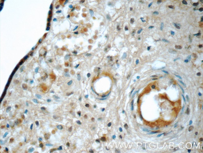 NRBF2 Antibody in Immunohistochemistry (Paraffin) (IHC (P))