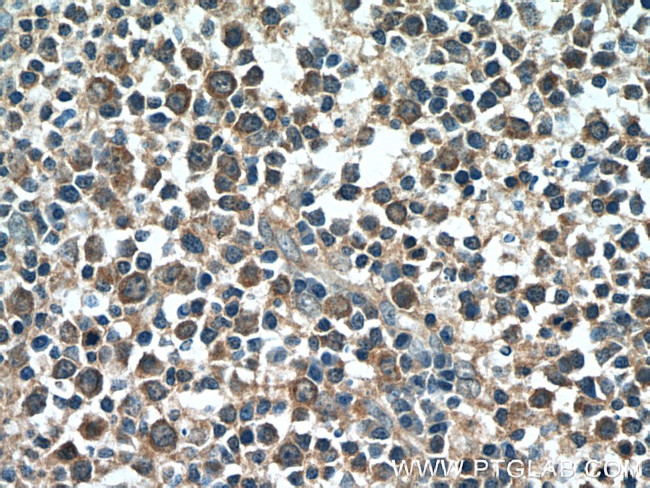 NRBF2 Antibody in Immunohistochemistry (Paraffin) (IHC (P))