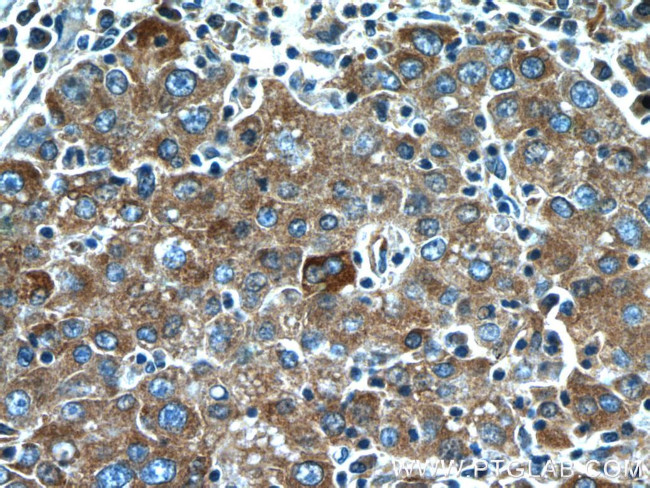 NRBF2 Antibody in Immunohistochemistry (Paraffin) (IHC (P))