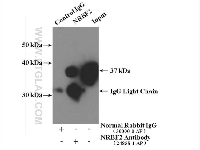 NRBF2 Antibody in Immunoprecipitation (IP)