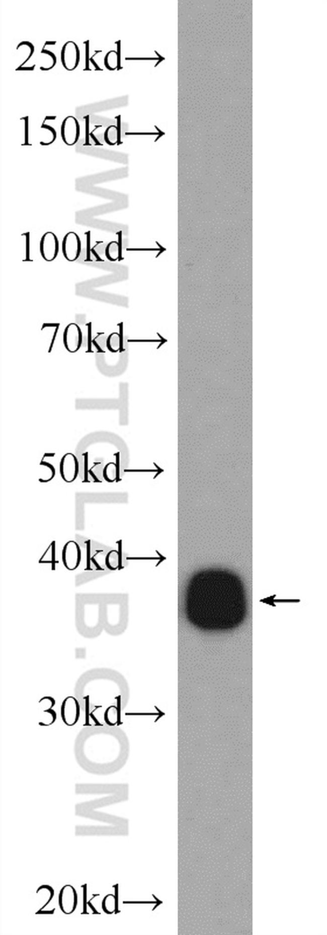 NRBF2 Antibody in Western Blot (WB)