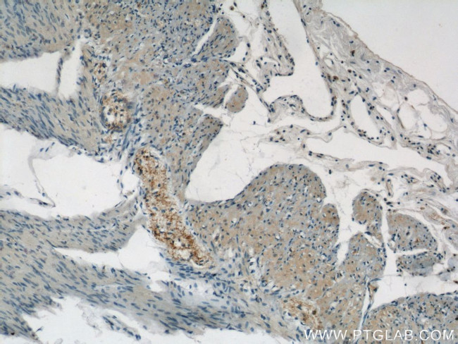 NMU Antibody in Immunohistochemistry (Paraffin) (IHC (P))