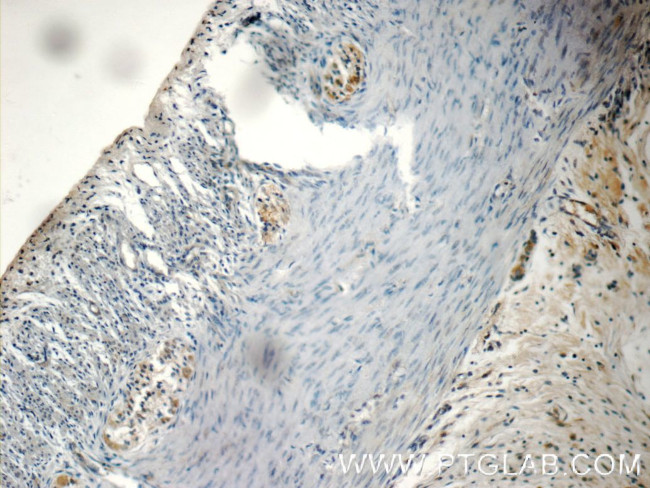 NMU Antibody in Immunohistochemistry (Paraffin) (IHC (P))