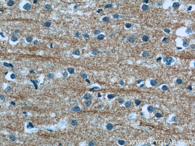 NMU Antibody in Immunohistochemistry (Paraffin) (IHC (P))