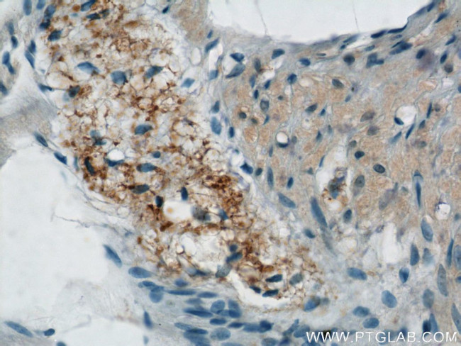 NMU Antibody in Immunohistochemistry (Paraffin) (IHC (P))