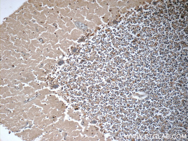 WDR81 Antibody in Immunohistochemistry (Paraffin) (IHC (P))