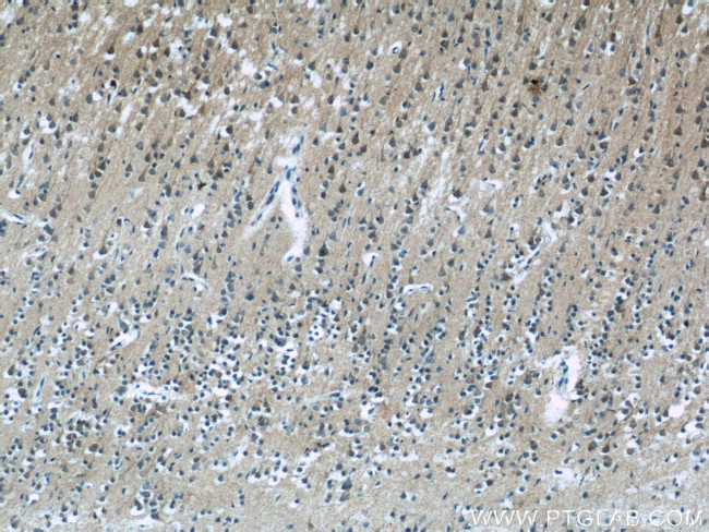 WDR81 Antibody in Immunohistochemistry (Paraffin) (IHC (P))