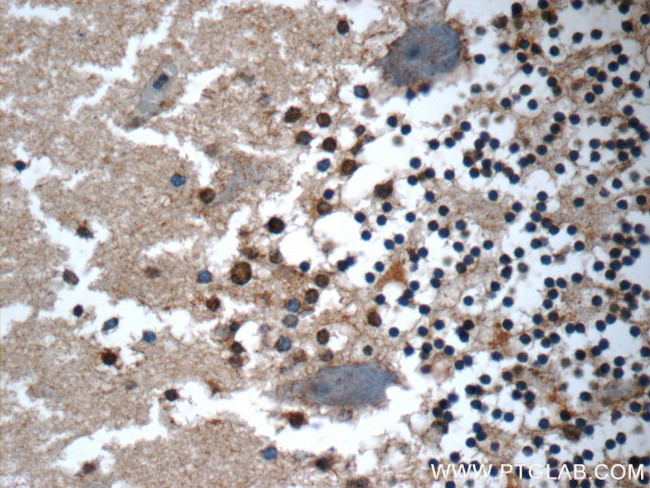 WDR81 Antibody in Immunohistochemistry (Paraffin) (IHC (P))