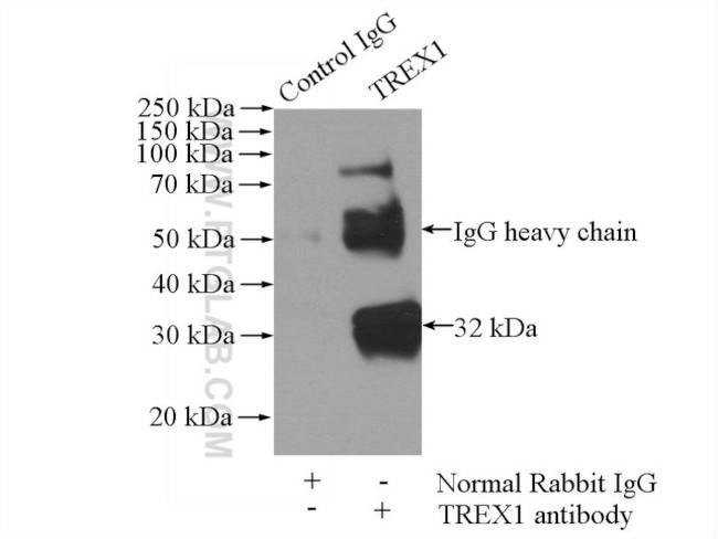 TREX1 Antibody in Immunoprecipitation (IP)