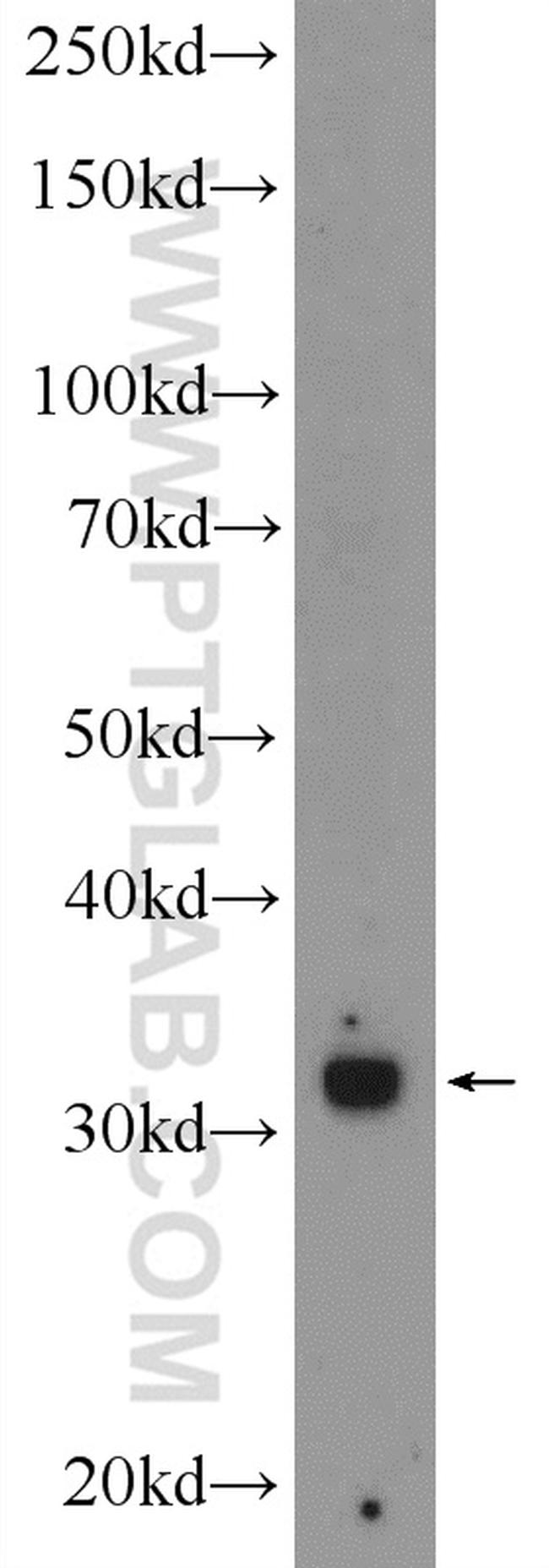 TREX1 Antibody in Western Blot (WB)