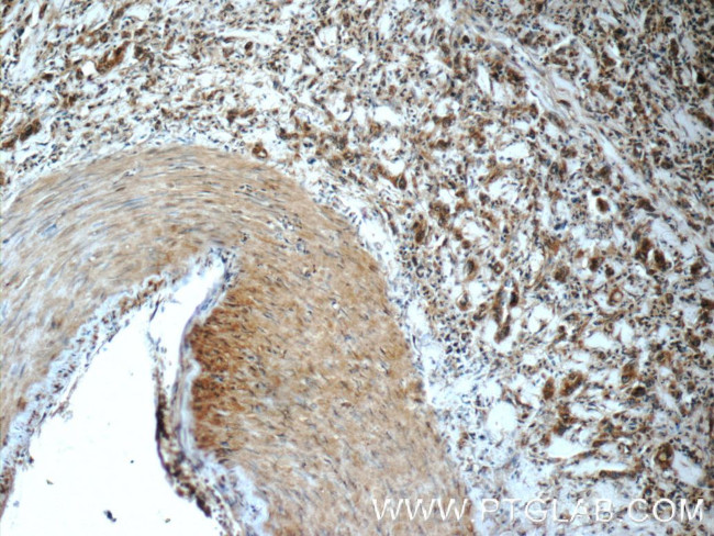 PPP2R3C Antibody in Immunohistochemistry (Paraffin) (IHC (P))